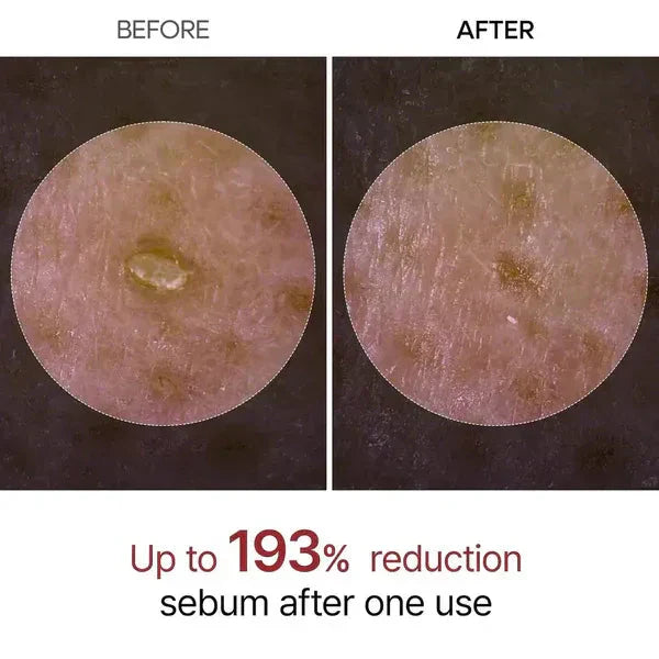 Dr. Melaxin Rice Peel Ampoule